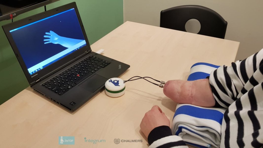 Implantát dokáže priniesť citlivosť